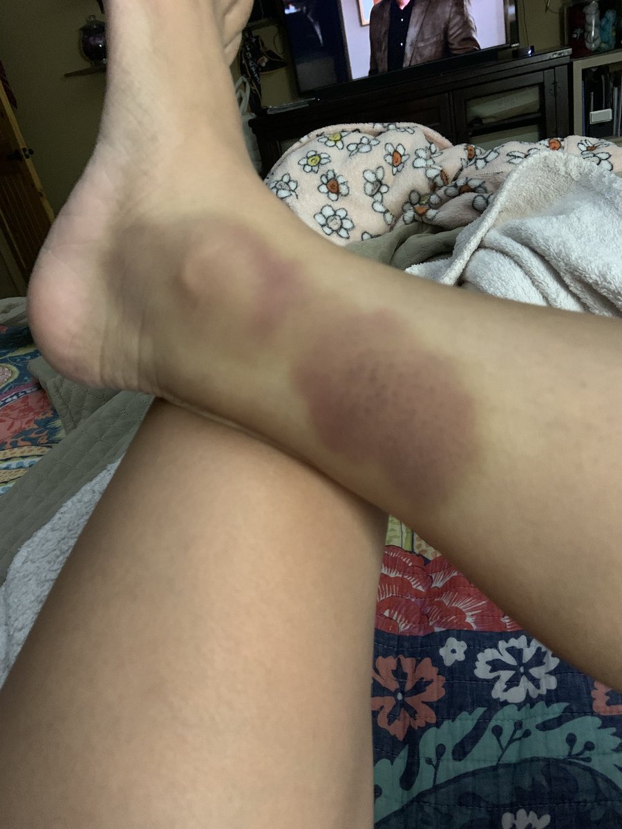 RockinASkirt's tweet image. Haven’t had a good one like that in a while.  #wrestling #footlocks #BJJ