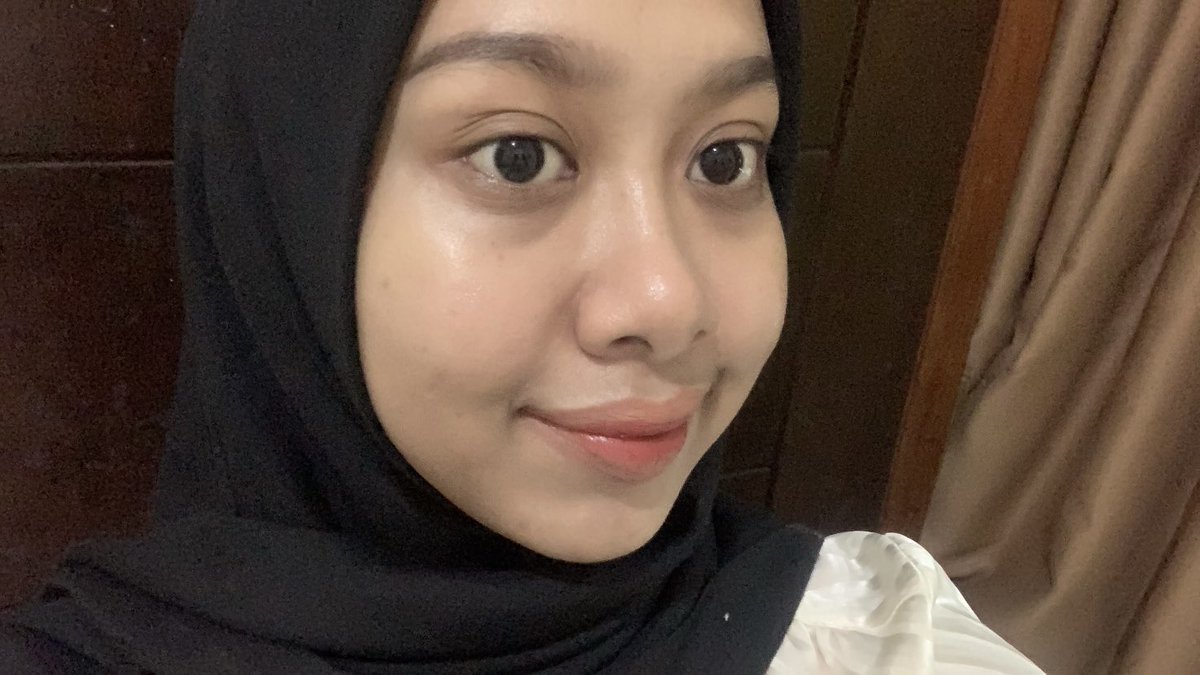 lippppeye's tweet image. ✨ THE POWER OF VITAMIN C + SUNSCREEN✨

gausah pusing pusing kalau kulit kusam! pake 2 combo produk ini, hasilnya pasti kelihatan as long rutin🙆‍♀️

before vs after  - rutin pakai vit c + ss‼️