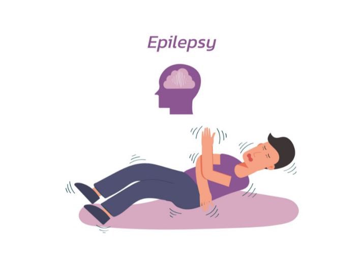 🦠 Dr. Ahmed Alanazi (@o_o_dr) on Twitter photo الان انت بطواري  وانت ممارس صحي 
جاتك حالة صرع Seizures (Status Epilepticus) الخطوات إذا م راجع المريض 
اولا: Initial Stabilization (0–5 minutes)
خمس أشياء مهمه بالبداية قبل كل شي 
1- ABCs : النفس  ومجرى التنفس مفتوح والعلامات الحيوية الان انت بطواري  وانت ممارس صحي 
جاتك حالة صرع Seizures (Status Epilepticus) الخطوات إذا م راجع المريض 
اولا: Initial Stabilization (0–5 minutes)
خمس أشياء مهمه بالبداية قبل كل شي 
1- ABCs : النفس  ومجرى التنفس مفتوح والعلامات الحيوية