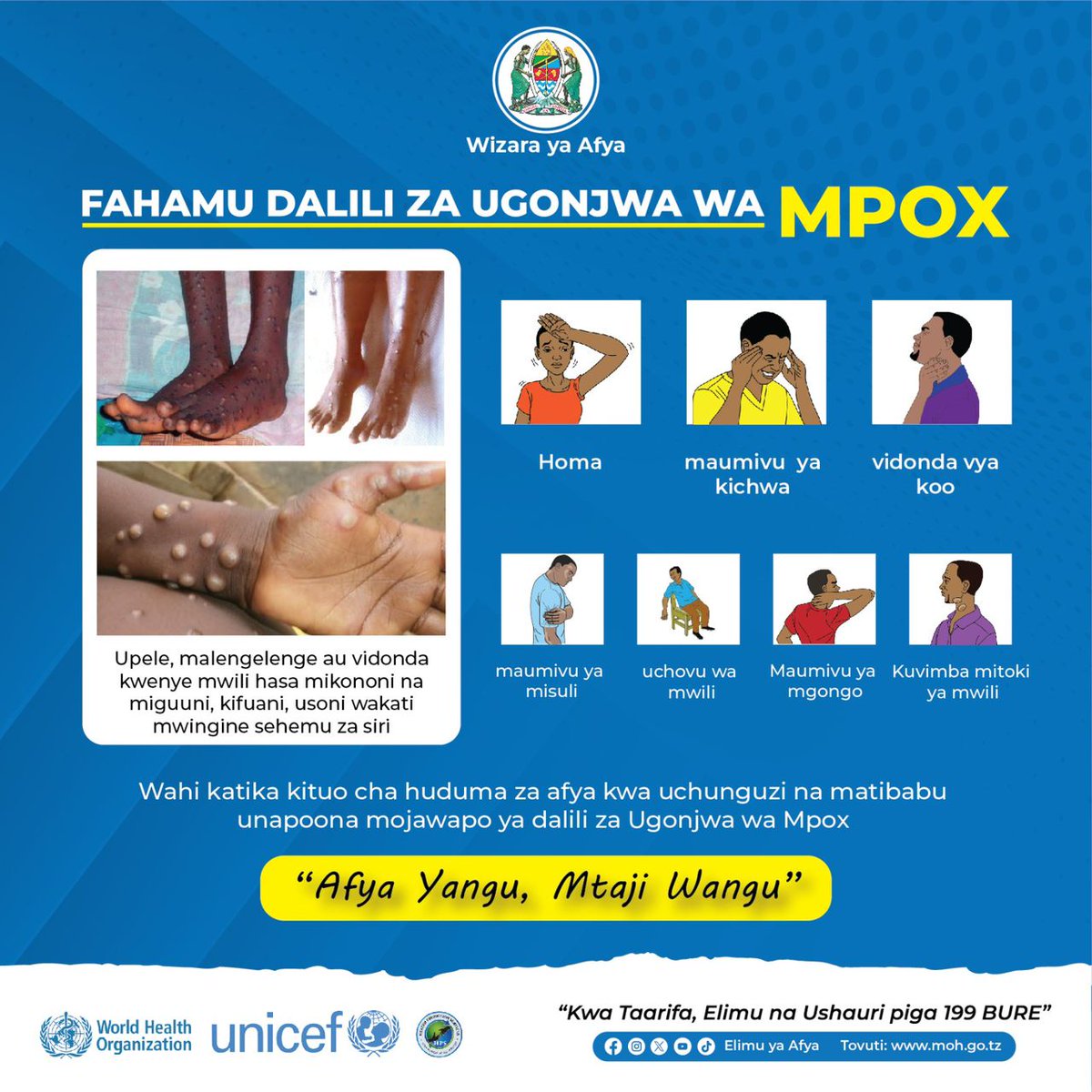 NJIA NA DALILI ZA MPOX.