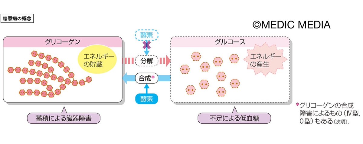 糖原病の概念】糖原病は，グリコーゲン代謝に関与する酵素が欠損し