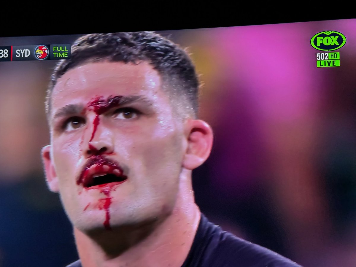 Wow #NRLPanthersRoosters