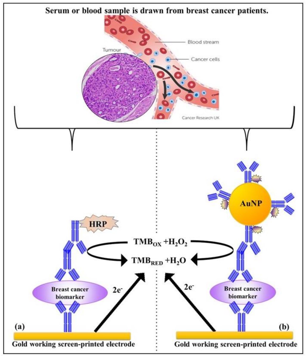 Biosensors_MDPI's tweet image. #Review
Development of Electrochemical Immunosensors for HER-1 and HER-2 Analysis in Serum for Breast Cancer Patients
by Shayalini Wignarajah, Iva Chianella and Ibtisam E. Tothill
mdpi.com/2079-6374/13/3…
@MDPIOpenAccess
@ChemMatSci_MDPI
 
#Immunosensors #Cancer #biosensors