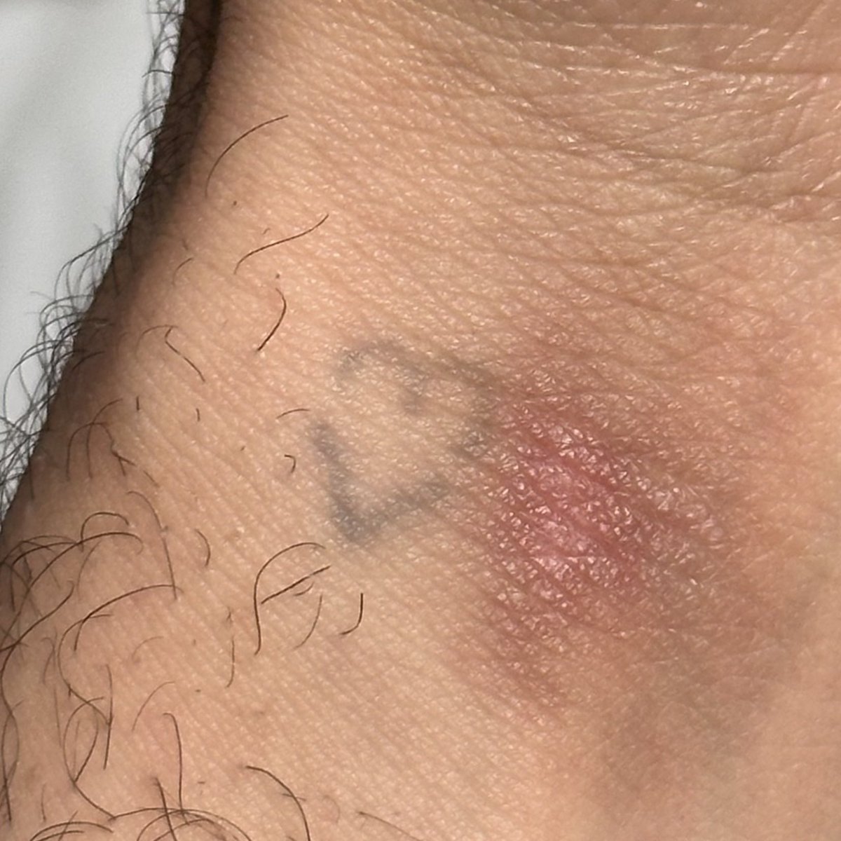 fox (@neptuniont) on Twitter photo 