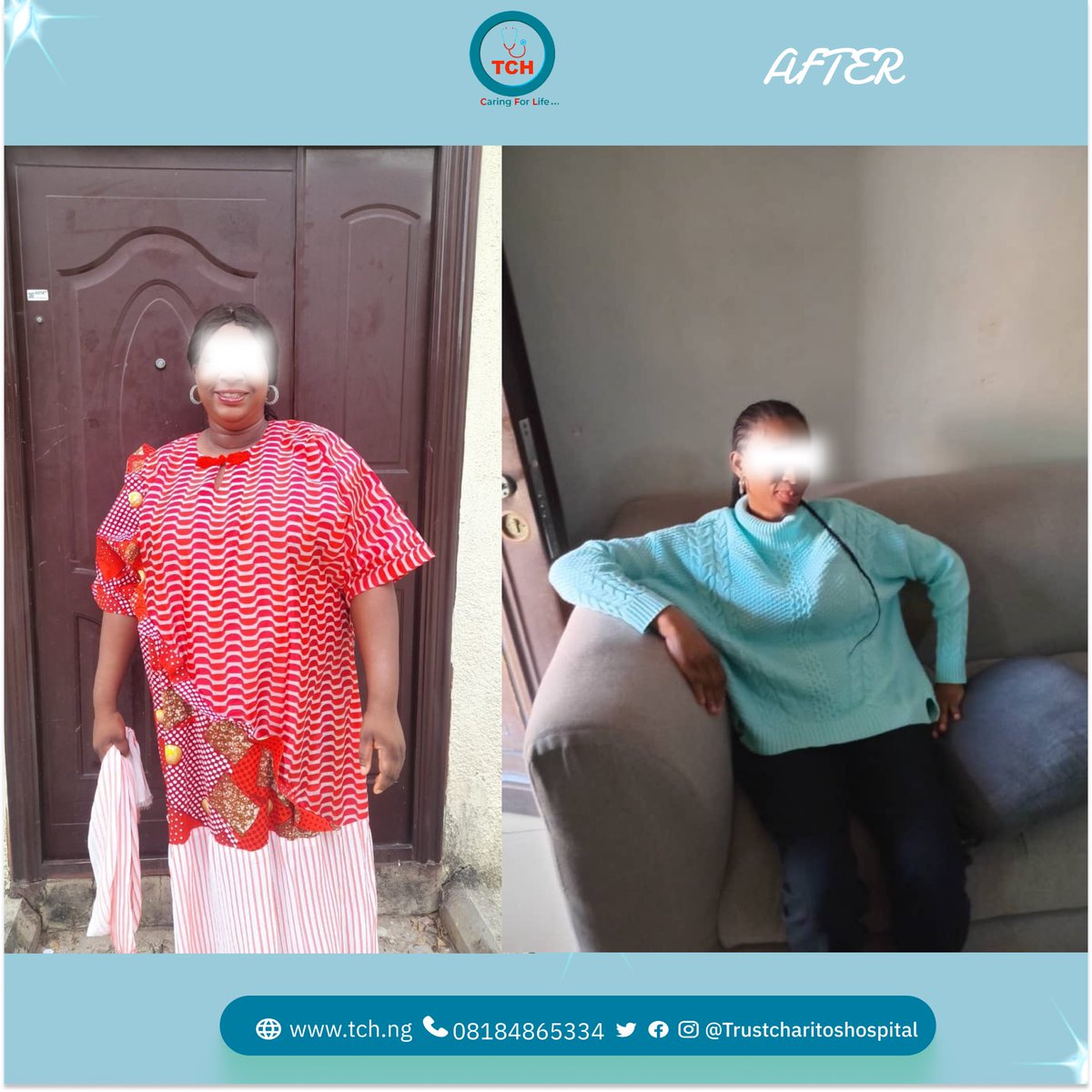 Another Incredible Transformation Alert!

From struggling with weight to confidently living healthier TCH is making dreams a reality!
This is more than just weight loss; it’s a total life upgrade through our safe and effective Gastric Sleeve procedure.

Why are more people