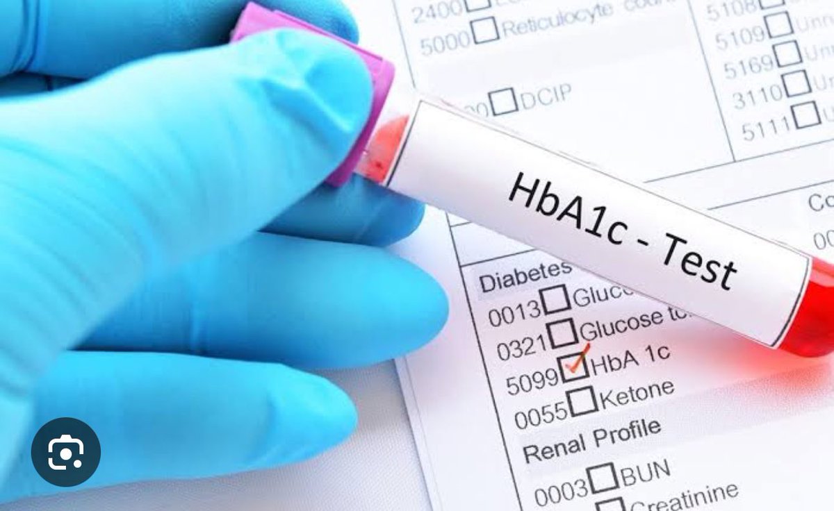 BEYOND WEIGHT
In 2016 my weight was 120kgs and HbA1C was 12.7 despite high medication. As I lost weight diabetes control was better. Last 3 years I have been off medications and my HbA1C has been stable at 5. Life style and optimal weight can reverse diabetes!
#obesity #diabetes