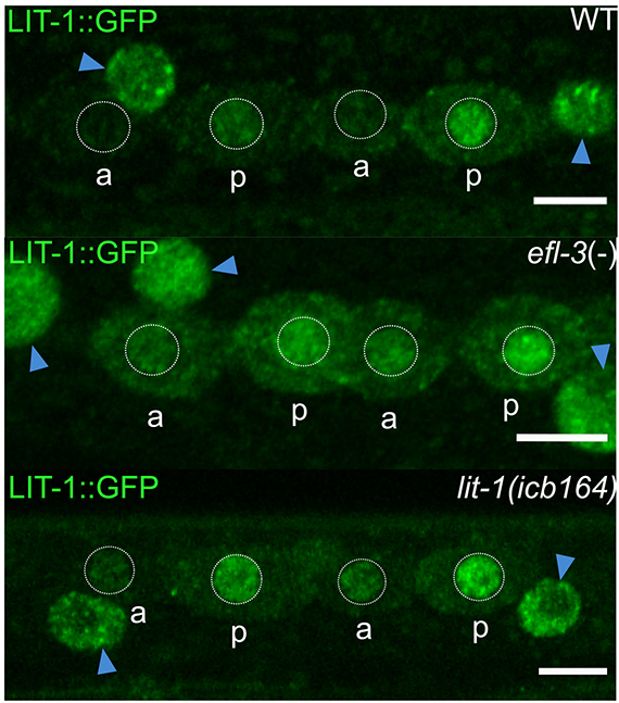 EFL-3/E2F7 modulates Wnt signalling by repressing the Nemo-like kinase LIT-1 during asymmetric epidermal cell division in C. elegans

Read this <a href="/ReviewCommons/">Review Commons</a> transfer article by
<a href="/MarFerrandoMar1/">Mar Ferrando Marco</a> &amp; <a href="/barkoulab/">Barkoulas Lab</a> <a href="/imperialcollege/">Imperial College London</a>:
journals.biologists.com/dev/article/15…