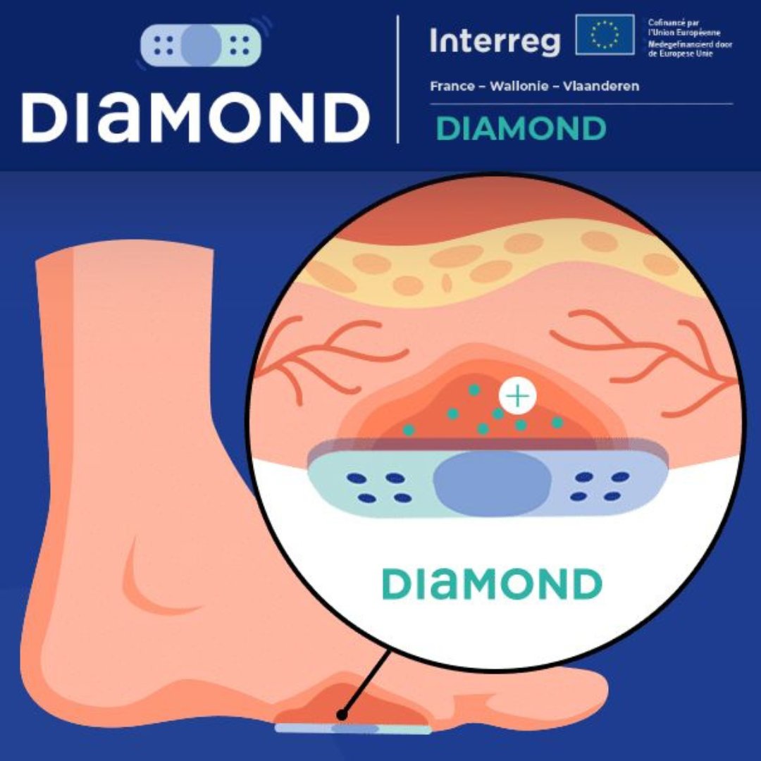 RESEARCH TOPIC UNDER THE MICROSCOPE 🔬 

The aim of the #DIAMOND-project is to develop an intelligent bandage for diabetic wounds with real-time monitoring and controlled drug release.

Learn more about this topic on our website 👉 ugent.be/ea/match/texti…
