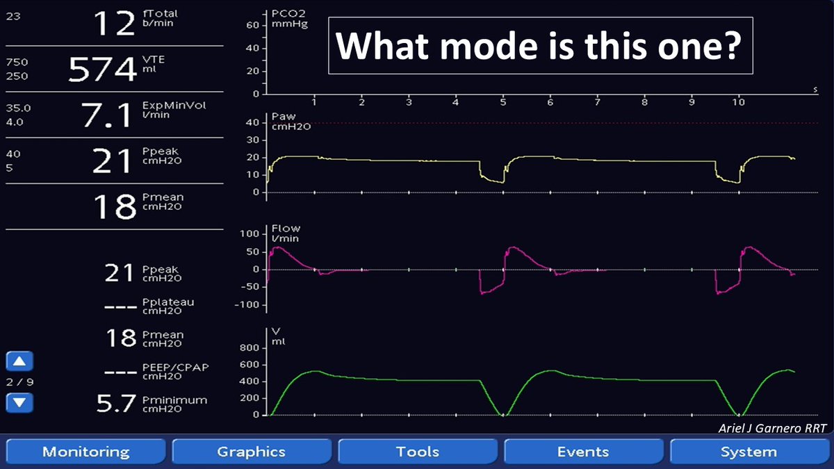 Ariel J Garnero (@arielg_rrt) on Twitter photo Mode recognition: What mode is this one? How does it work? What is the TAG? <a href="/DocMusician/">Doc Musician</a> <a href="/DrMiguelIbarra1/">Dr. Miguel Ibarra-Estrada</a> <a href="/emireles_c/">Eduardo Mireles-Cabodevila</a> <a href="/CCF_PCCM/">CCF Pulmonary and Critical Care Fellows</a> <a href="/IM_Crit_/">IMCrit</a> <a href="/critconcepts/">Critical Concepts</a> <a href="/ATC_Ventilator/">Ben Fabry</a> <a href="/Vent_Busters/">VentBusters</a> <a href="/OfVentilation/">Society of Mechanical Ventilation</a> <a href="/SaudiRTs/">Saudi Respiratory</a> <a href="/RespiratorySCCM/">SCCM Respiratory Care Section</a> <a href="/respitroy/">Troy Whitacre</a> Mode recognition: What mode is this one? How does it work? What is the TAG? <a href="/DocMusician/">Doc Musician</a> <a href="/DrMiguelIbarra1/">Dr. Miguel Ibarra-Estrada</a> <a href="/emireles_c/">Eduardo Mireles-Cabodevila</a> <a href="/CCF_PCCM/">CCF Pulmonary and Critical Care Fellows</a> <a href="/IM_Crit_/">IMCrit</a> <a href="/critconcepts/">Critical Concepts</a> <a href="/ATC_Ventilator/">Ben Fabry</a> <a href="/Vent_Busters/">VentBusters</a> <a href="/OfVentilation/">Society of Mechanical Ventilation</a> <a href="/SaudiRTs/">Saudi Respiratory</a> <a href="/RespiratorySCCM/">SCCM Respiratory Care Section</a> <a href="/respitroy/">Troy Whitacre</a>
