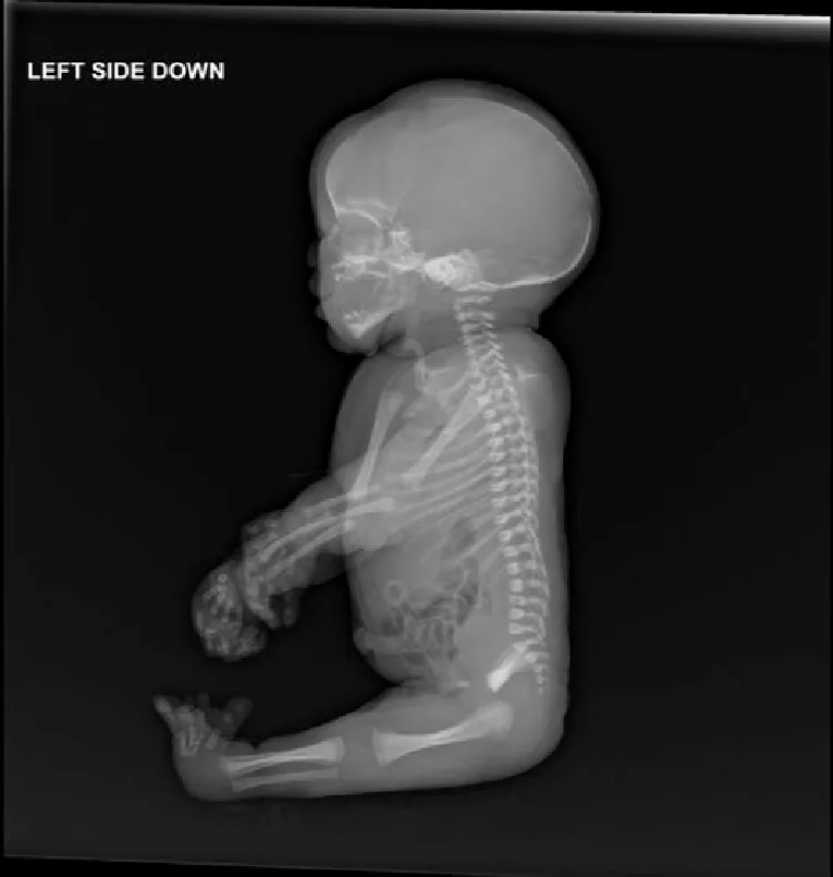 realPatrickJr's tweet photo. TRAGIC: "Inactive" ingredients in medicine have KILLED newborn babies.

Their small bodies couldn't process a common additive found in many medications.

Elderly people face the same deadly risk.

What they're not telling you about your medicine could save a life... https://t.co/KyT97TL9f1