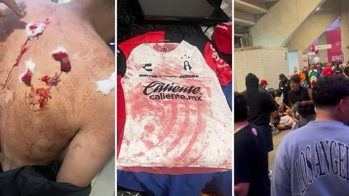 SoyFielAtlas's tweet image. Muy bien, ojalá también resuelvan este intento de homicidio. Que solo representó la reducción del 25% de aforo en un partido.