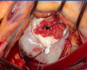 Ritu Thamman MD tweet media