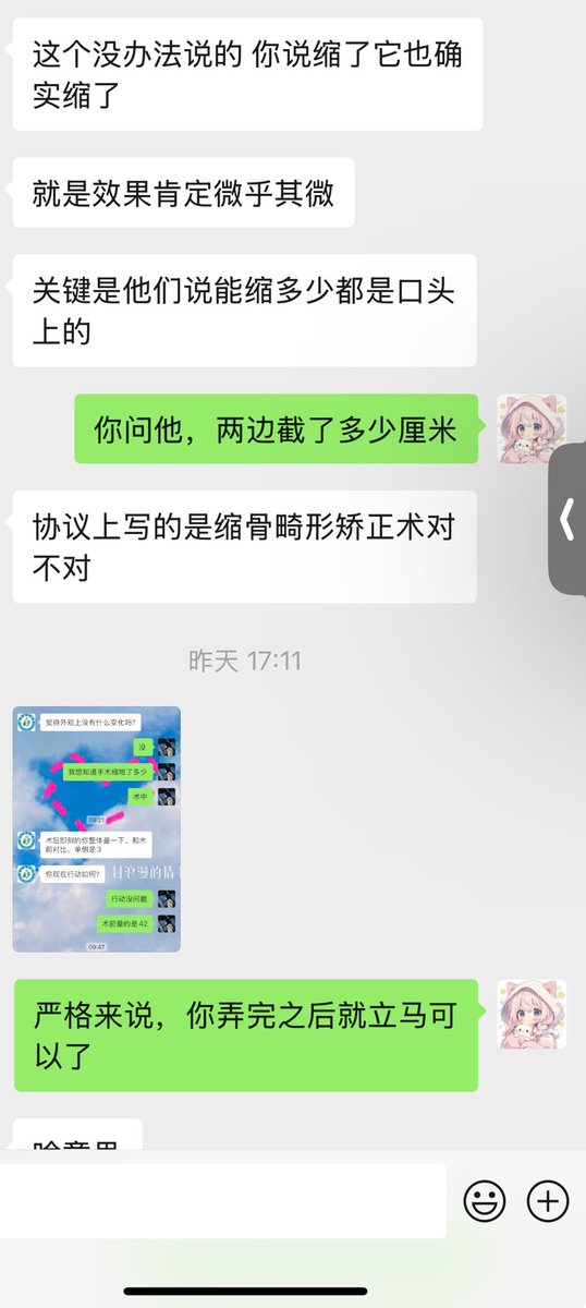 关于锁肩手术，可能要泼个冷水，效果可能未必有那么好，如果一旦抱有较高期待，且手术没有达到预期，很可能不如不做。