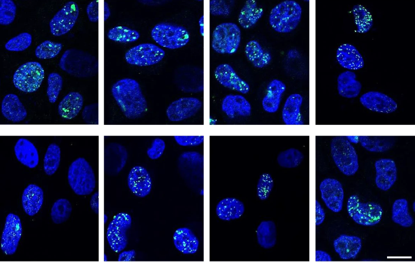 💊 Researchers with Drs. Emmanuelle Charafe-Jauffret (<a href="/Emmachadtem/">Emmanuelle Charafe</a>) and Christophe Ginestier (<a href="/ChrisGinestier/">Christophe Ginestier</a>) at <a href="/crcm_marseille/">CRCM - Cancer Research Centre of Marseille</a> demonstrate that Nifuroxazide was a prodrug that was specifically bioactivated in breast CSCs.

<a href="/NatureComms/">Nature Communications</a> | go.nature.com/4hbVcSX