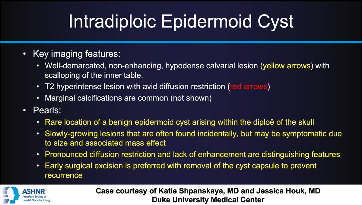 ASHNR (@ashnrsociety) on Twitter photo #ASHNRCOTW #288: ANSWER. Thx Dr.
<a href="/KatieShp19/">Katie Shpanskaya</a> + @jhoukMD4 case! #ASHNR25
<a href="/callyrobs/">Caroline Robson, MBChB</a> <a href="/DShatzkes/">Deborah Shatzkes</a> <a href="/CDP_Rad/">C Douglas Phillips 🇺🇸</a> <a href="/rhwiggins/">Richard Wiggins</a>
<a href="/nakoontz/">Nicholas Koontz</a> <a href="/KRileyMD/">Kalen Riley</a> <a href="/CMGlastonbury/">Christine M Glastonbury, MD</a>
<a href="/tabby_kennedy/">Tabby A. Kennedy, MD</a> @PhilipRChapman <a href="/cmtomblinson/">Courtney Tomblinson, MD</a> <a href="/amyfjuliano/">Amy Juliano</a> <a href="/bpoliceni/">Bruno Policeni</a> <a href="/MohitTCCNeuro/">Mohit Agarwal</a> <a href="/AshokSrini15/">Ashok Srinivasan</a> <a href="/KatieTraylorDO/">Katie S. Traylor MS, DO, DABR</a> <a href="/CynXinWu/">Cynthia Xin Wu</a> #ASHNRCOTW #288: ANSWER. Thx Dr.
<a href="/KatieShp19/">Katie Shpanskaya</a> + @jhoukMD4 case! #ASHNR25
<a href="/callyrobs/">Caroline Robson, MBChB</a> <a href="/DShatzkes/">Deborah Shatzkes</a> <a href="/CDP_Rad/">C Douglas Phillips 🇺🇸</a> <a href="/rhwiggins/">Richard Wiggins</a>
<a href="/nakoontz/">Nicholas Koontz</a> <a href="/KRileyMD/">Kalen Riley</a> <a href="/CMGlastonbury/">Christine M Glastonbury, MD</a>
<a href="/tabby_kennedy/">Tabby A. Kennedy, MD</a> @PhilipRChapman <a href="/cmtomblinson/">Courtney Tomblinson, MD</a> <a href="/amyfjuliano/">Amy Juliano</a> <a href="/bpoliceni/">Bruno Policeni</a> <a href="/MohitTCCNeuro/">Mohit Agarwal</a> <a href="/AshokSrini15/">Ashok Srinivasan</a> <a href="/KatieTraylorDO/">Katie S. Traylor MS, DO, DABR</a> <a href="/CynXinWu/">Cynthia Xin Wu</a>