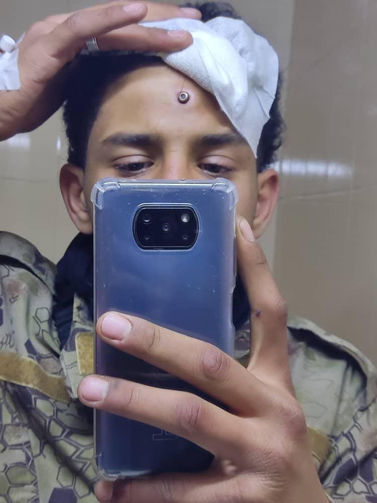 ليث احد رجال الجيش السوري تلقى رصاصة في جبهته في معارك الساحل مع فلول الاسد

 لكن لطف الله به كان أقوى من الرصاصة