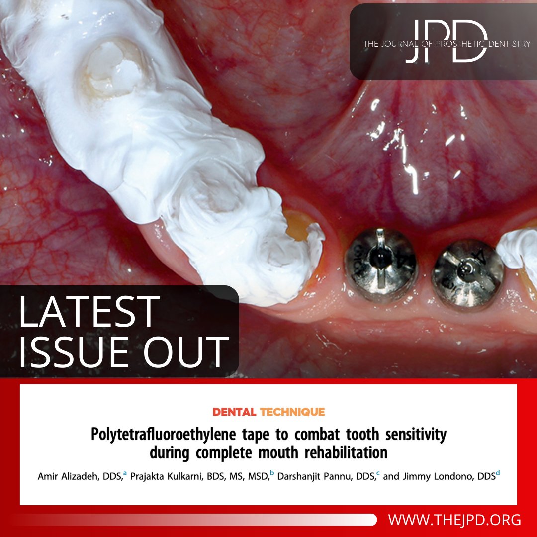 JPDentistry's tweet image. This #dentaltechnique from the latest issue of #theJPD describes how polytetrafluoroethylene tape can be used to limit #toothsensitivity during active treatment: thejpd.org/article/S0022-…