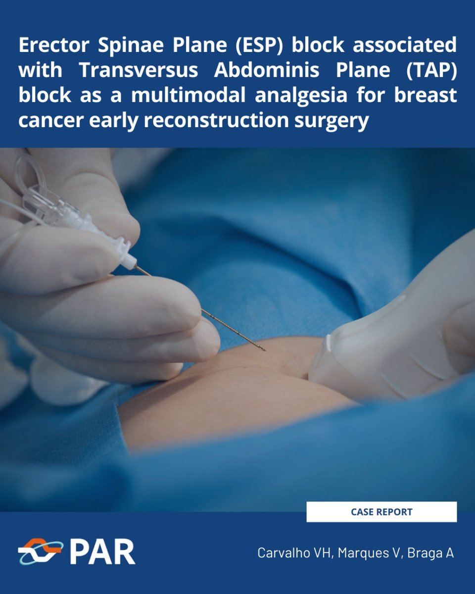 journal_PAR's tweet image. This report demonstrate an anesthetic technique ESP block associated with TAP block to avoid acute pain in a patient submitted to radical mastectomy with early skin flap reconstruction.
Read in full: par.saesp.org.br/article/doi/10…
#journalPAR #openaccess #tapblock #espblock #casereport