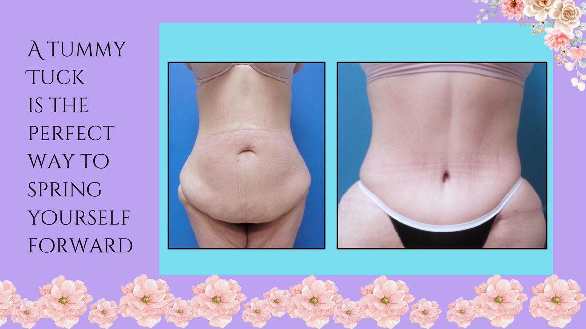 topdocSA's tweet photo. #topratedplasticsurgeon #fergusonfabulous #sanantonio #texas #drferguson #제이홉 https://t.co/L2ClcQMouq