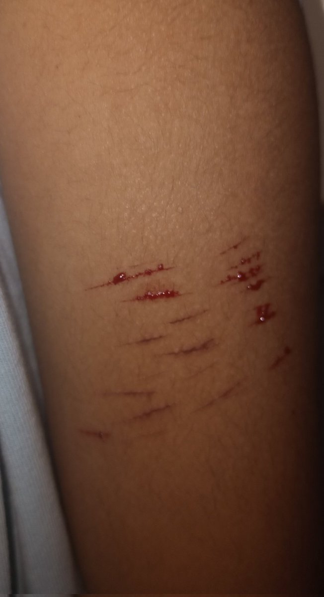 Cortesitos:b #selfharm #SH #Styro