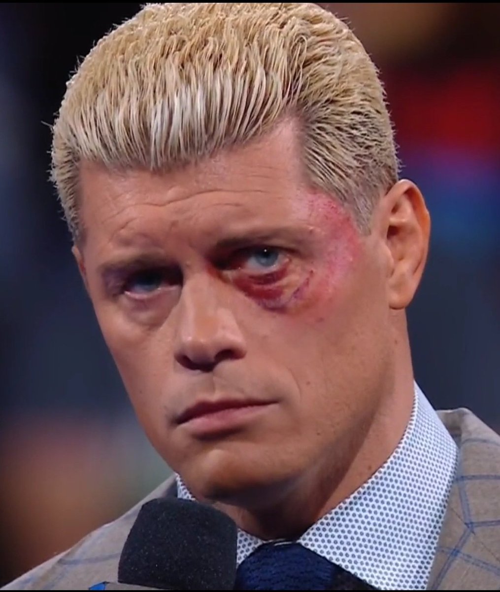 BRO REALLY TOOK A BLACK EYE 
FOR THE LOVE OF THEM GAME 

PUT SOME RESPECT ON HIM