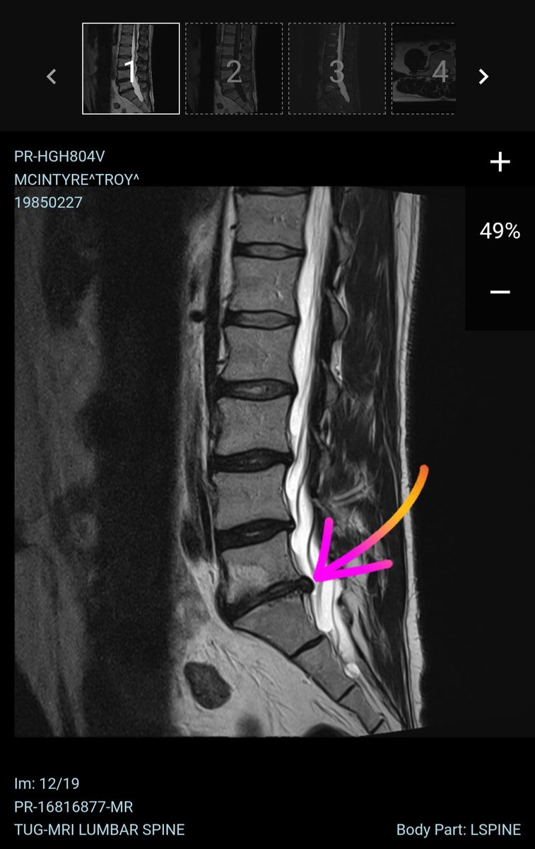JumpingBeansTTV tweet media