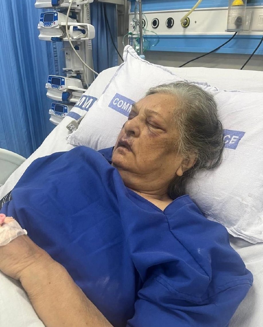 82 years old lady ends up in ICU as Air India refused wheelchair service as a result of which she fell. 

In her ticket details she had confirm wheelchair service.

Strict action is needed against Air India officials.