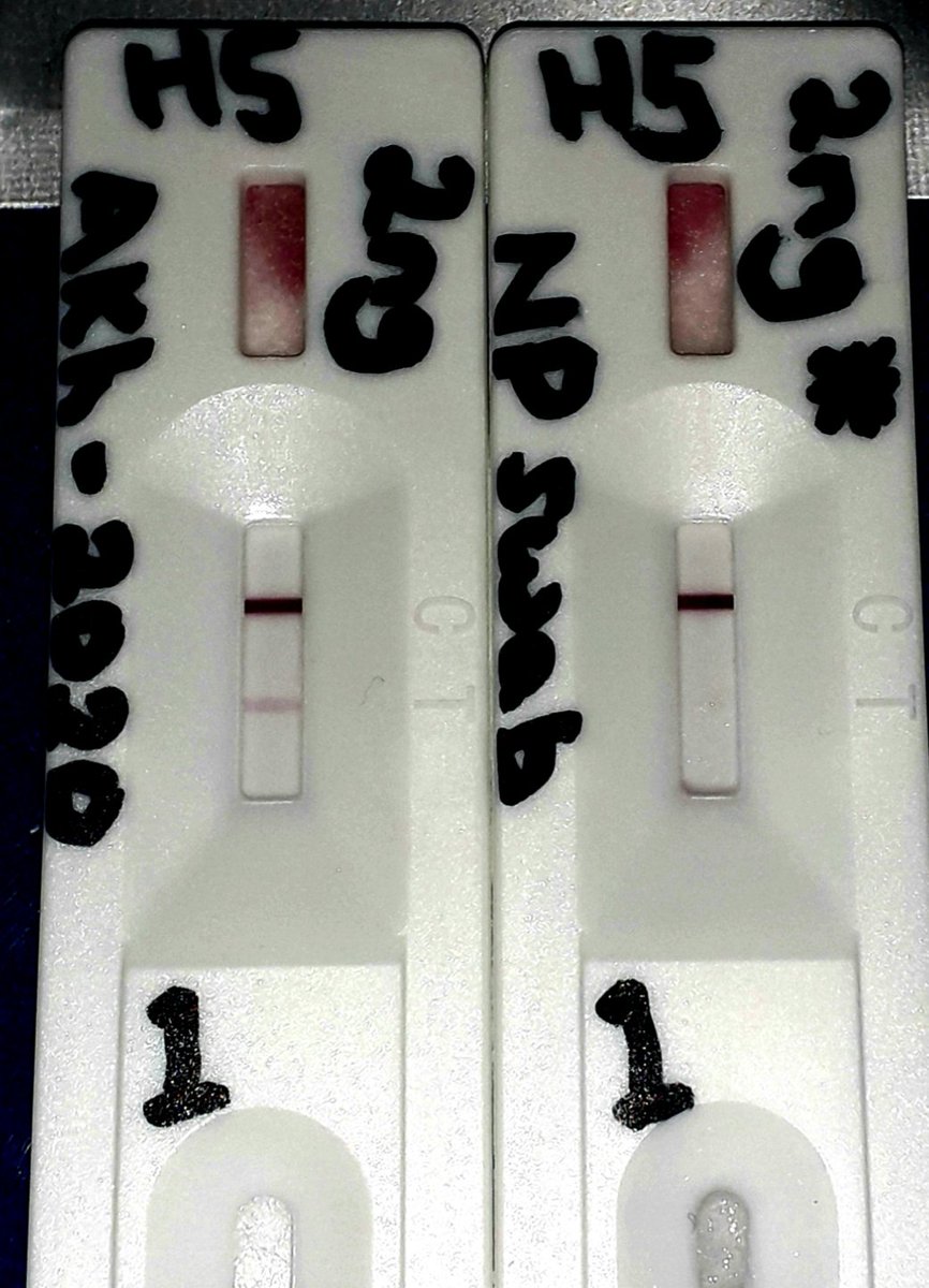 H5 Avian Flu Rapid Test – Breakthrough! 🚨

Our advanced rapid antigen test (RAT) for H5 hemagglutinin shows strong performance in initial human nasal sample testing! ✅

🔬 Key results:
• Fairly sensitive: LOD <0.5ng
• Human NP matrix detection: Clear at 2ng
• Outperforms