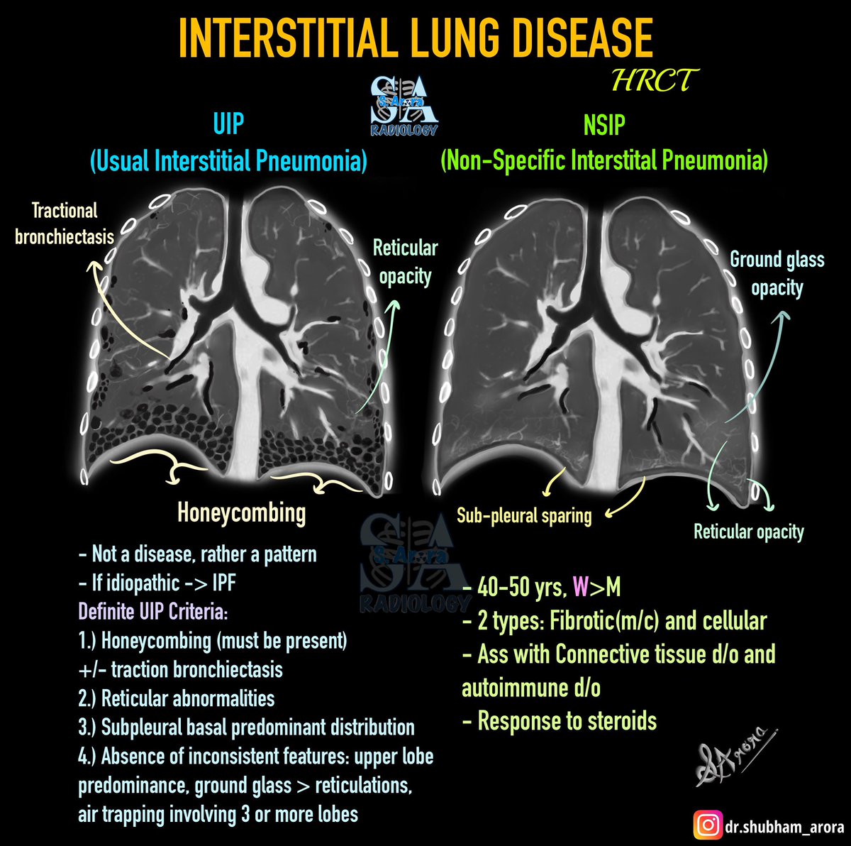 UIP V/S NSIP

#MedX