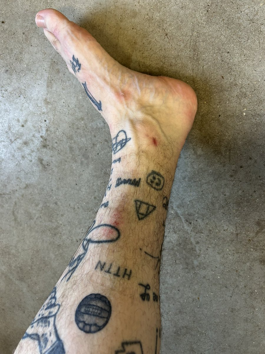 Hatrick and a wallop on the shin in a 7-2 win. Pretty decent start to the day! 
⚽️ ⚽️ ⚽️