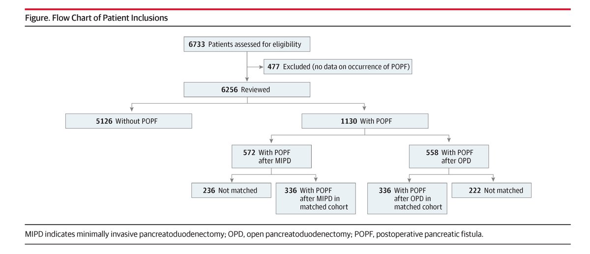 Pancreatic fistula following MIPD vs OPD is associated with higher rates of secondary complications, postpancreatectomy hemorrhage, longer hospital stays, and increased reoperation rates. ja.ma/4kwdot6