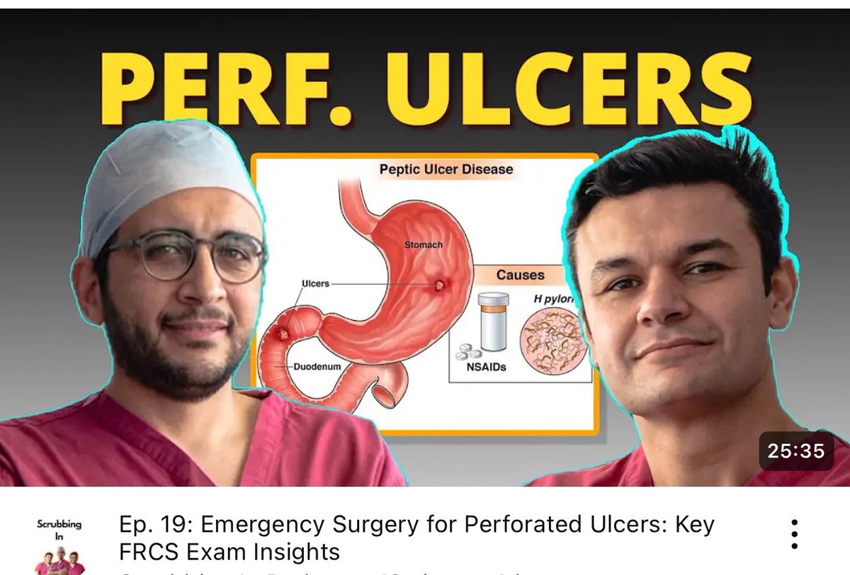 Alan Askari (@alan_askari) on Twitter photo Don’t miss the latest episode of <a href="/scrubbingin1/">Scrubbing In</a> - Perforated DU, important need to knows for the exam youtu.be/rNapfXk_A2s?si… and on podcast:
open.spotify.com/show/6H8aokOQH…
podcasts.apple.com/gb/podcast/scr…
<a href="/ASGBI_MA/">ASGBI Moynihan Academy</a> <a href="/asgbi/">ASGBI</a> <a href="/Augishealth/">AUGIS</a> <a href="/roux_group/">The Roux Group</a> <a href="/Dukes_Club/">The Dukes' Club</a> <a href="/STEER_UK/">STEER Collaborative</a> <a href="/HFrcs/">Higher FRCS - Higher Vasc - Higher VIVA</a> Don’t miss the latest episode of <a href="/scrubbingin1/">Scrubbing In</a> - Perforated DU, important need to knows for the exam youtu.be/rNapfXk_A2s?si… and on podcast:
open.spotify.com/show/6H8aokOQH…
podcasts.apple.com/gb/podcast/scr…
<a href="/ASGBI_MA/">ASGBI Moynihan Academy</a> <a href="/asgbi/">ASGBI</a> <a href="/Augishealth/">AUGIS</a> <a href="/roux_group/">The Roux Group</a> <a href="/Dukes_Club/">The Dukes' Club</a> <a href="/STEER_UK/">STEER Collaborative</a> <a href="/HFrcs/">Higher FRCS - Higher Vasc - Higher VIVA</a>