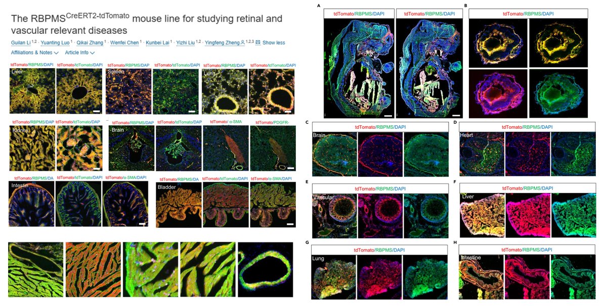 Hao Yin (@haoyin20) on Twitter photo RBPMS (splicing factor)-CreERT2 mice
Active in a broad collection of cell types, incld #SmoothMuscleCell #Pericyte #Cardiomyocyte & more & more
<a href="/iScience_CP/">iScience journal</a> 2023
cell.com/iscience/fullt… RBPMS (splicing factor)-CreERT2 mice
Active in a broad collection of cell types, incld #SmoothMuscleCell #Pericyte #Cardiomyocyte & more & more
<a href="/iScience_CP/">iScience journal</a> 2023
cell.com/iscience/fullt…
