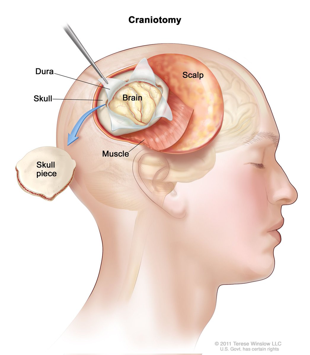 YesAlexisRwanda's tweet photo. EggGo Rwanda | Knowledge Assistant
1. What can be done to prevent brain cancer?
A) Avoid smoking and excessive alcohol consumption
B) Eat a balanced diet rich in omega-3
C) Always wear a hat when exposed to the sun
D) Avoid using a phone for long periods
#LearnMoreAbout https://t.co/cH7g8oQtap