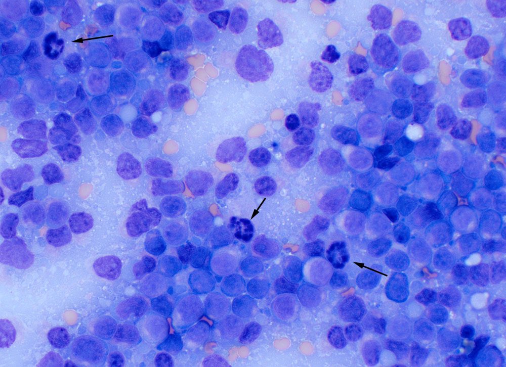 Lymph node aspirates from a cat with an aggressive lymphoma: How many mitotic figures do you count in the first image (popliteal lymph node, 20x objective)? In the second image (jejunal lymph node), there are 3 mitoses (arrows, 50x objective).