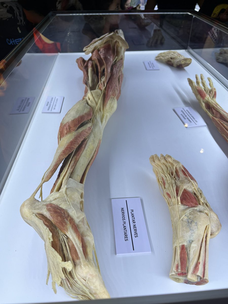 calwnnd's tweet photo. Vayan al museo de cuerpos en Miraflores https://t.co/1hmsDDt8l1