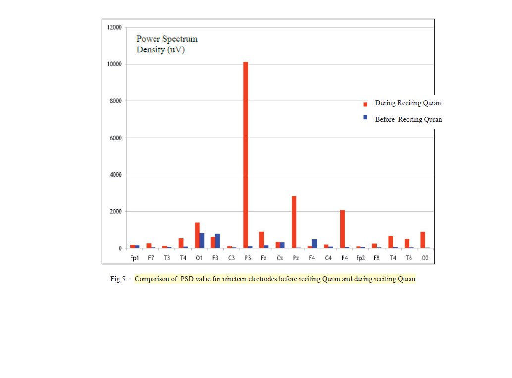 Jumpsmash_'s tweet image. Mau share hasil riset menarik! Membaca Al-Qur'an dapat mengaktifkan gelombang Alpha yang ada didalam otak kita. Si gelombang Alpha ini yang membantu manusia untuk merasa lebih rileks, tenang, santai, mindful dan dapat mengurangi stres maupun cemas. So, jangan lupa tilawah yaa!😆