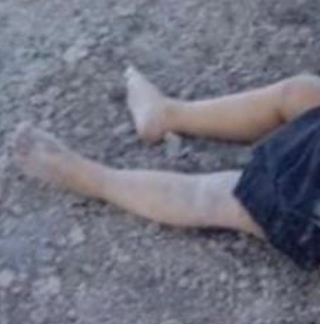 Konya Karatay'da "köpekler tarafından öldürüldü" diye medya aracılığıyla servis edilem fotoğraflarda 2 yaşında kızın belden aşağısı çıplak, kafası darbe almış. Otopsi yapıldı mı? Bir cinayetin üstü mü örtülüyor? Bu soruların cevabı derhal verilmedi. #Karatay