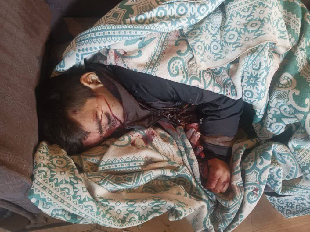 hatem_io's tweet photo. @AuswaertigesAmt Siehst du dieses kleine Mädchen und den anderen Mann? Das ist das Ergebnis des Willens unserer Regierung Al Qaida in Syrien zu unterstützen.  Bitte ale teilen BITTE
https://t.co/ppTLqKjJEg https://t.co/lHHb72EI8w