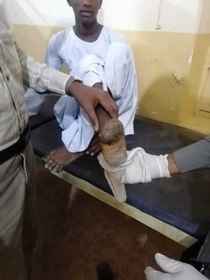 MycetomaRC's tweet image. Exciting news! Dr. Abdalla Othman, consultant microbiologist, joins the Mycetoma Clinic at Kassala University Hospital to train staff on diagnosing mycetoma. A pioneer in PCR for mycetoma diagnosis since the '90s, his expertise is a valuable asset to the Mycetoma Research Center!