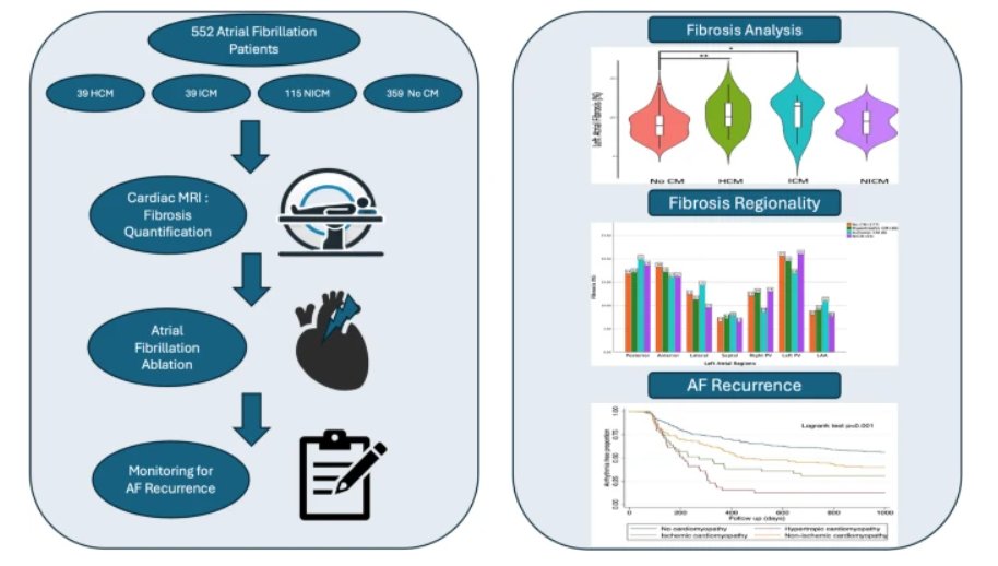 JICE (@jice_ep) on Twitter photo 🚨New #FreeRead Article in
<a href="/JICE_EP/">JICE</a>
Impact of Catheter Ablation on Atrial Fibrillation Outcomes in Various Cardiomyopathies: Findings from LGE-MRI Quantified Atrial Fibrosis Analysis
🧐📖 rdcu.be/ecM21
by <a href="/Ahmadkassar7/">Ahmad Kassar</a>, <a href="/nadiachamoun/">Nadia Chamoun</a>, <a href="/RomanosHaykal/">Romanos Haykal</a>, <a href="/YaacoubC/">Yaacoub C. Chahine</a>, 🚨New #FreeRead Article in
<a href="/JICE_EP/">JICE</a>
Impact of Catheter Ablation on Atrial Fibrillation Outcomes in Various Cardiomyopathies: Findings from LGE-MRI Quantified Atrial Fibrosis Analysis
🧐📖 rdcu.be/ecM21
by <a href="/Ahmadkassar7/">Ahmad Kassar</a>, <a href="/nadiachamoun/">Nadia Chamoun</a>, <a href="/RomanosHaykal/">Romanos Haykal</a>, <a href="/YaacoubC/">Yaacoub C. Chahine</a>,