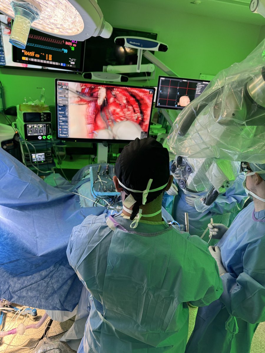 afshin salehi, M.D., M.S., FAANS (@afshinsalehi) on Twitter photo I find doing open corpus callosotomy using the exoscope allows for improved visualization, quicker and easier change of view point, better ergonomics, enhanced resident involvement.
<a href="/SynaptiveMed/">Synaptive Medical</a> <a href="/ChildrensNE/">Children's Nebraska</a> <a href="/UNMC_NeuroSurg/">UNMC Department of Neurosurgery</a> I find doing open corpus callosotomy using the exoscope allows for improved visualization, quicker and easier change of view point, better ergonomics, enhanced resident involvement.
<a href="/SynaptiveMed/">Synaptive Medical</a> <a href="/ChildrensNE/">Children's Nebraska</a> <a href="/UNMC_NeuroSurg/">UNMC Department of Neurosurgery</a>