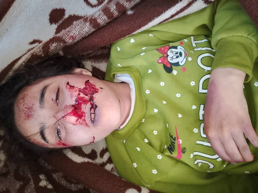 anasshabrah's tweet photo. 🚨 #Breaking | A massacre in the Syrian coast ⚡️‼️
Assad regime remnants have committed a brutal massacre against a Sunni family from Sahl al-Rouj, Idlib countryside, residing in the Syrian coast.

Even the most extreme groups who claimed to have killed their men never murdered women or children—but you have crossed every line! May God curse you, you pigs!

#Syria #SyrianCoast #AssadCrimes #WarCrimes #Genocide #HumanRights #Justice