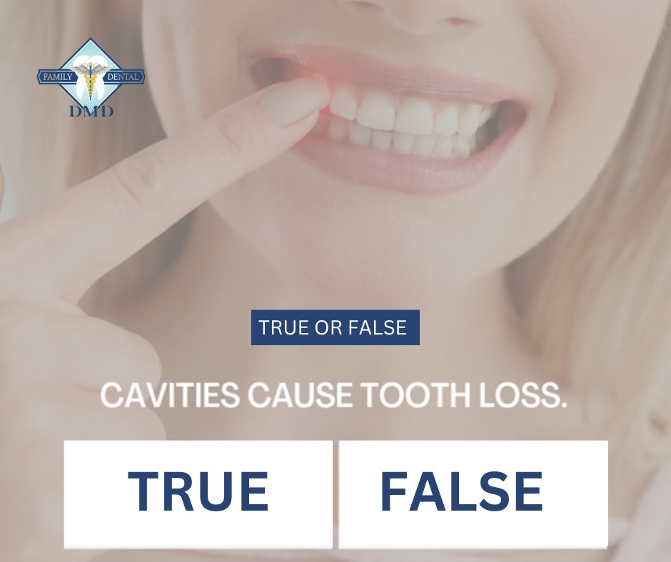 MansouriDMD's tweet image. TRUE: Cavities can cause tooth loss if tooth decay is not stopped in it's early stages. If you think you may have a cavity, don't put it off any longer - contact us today for an appointment.
#toothdecay #toothloss #dentalcare #oralhealth