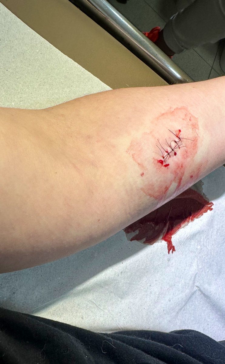 A primeira sutura a gente nunca esquece 😂