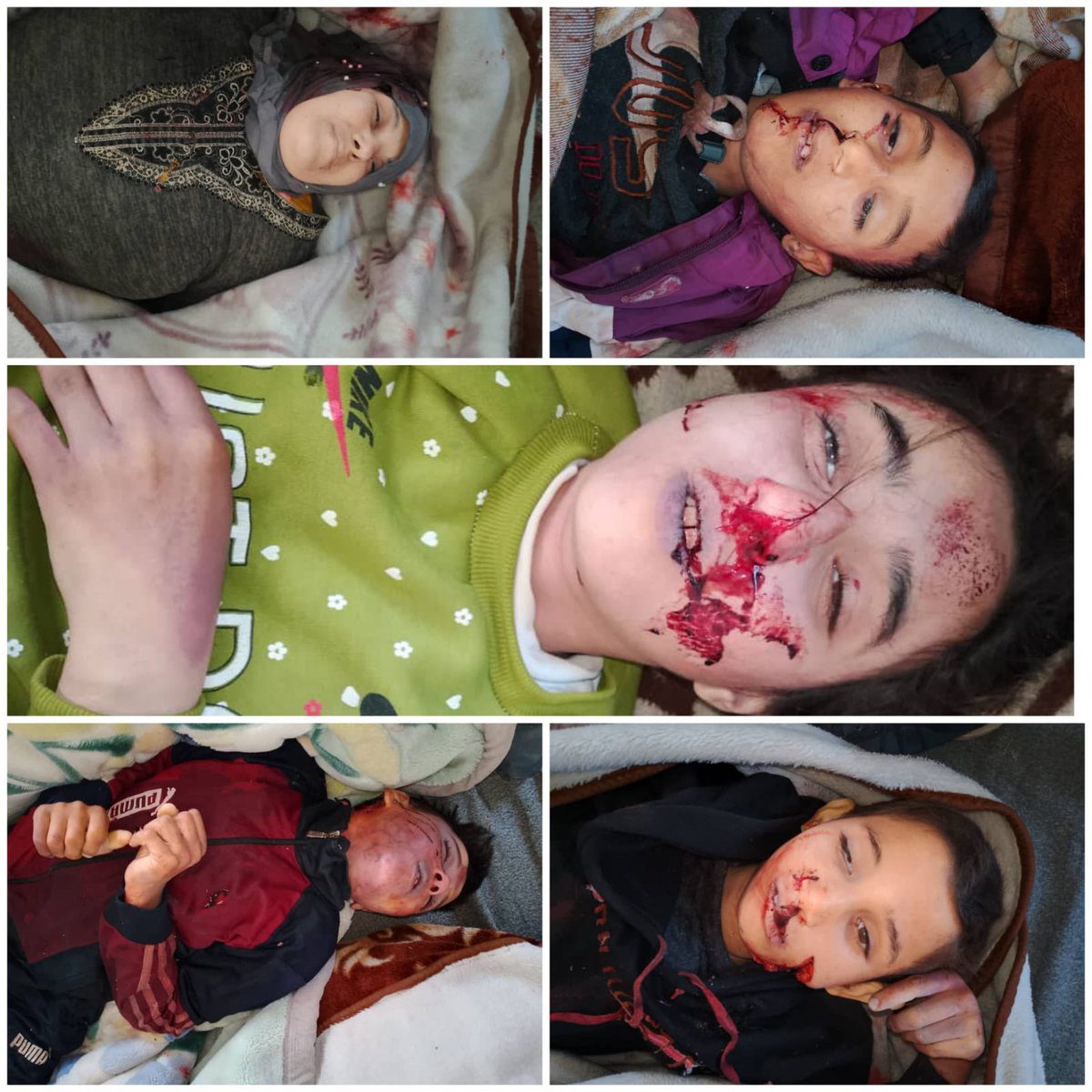 انقتلت عائلة كاملة على يد فلول النظام البائد في الساحل السوري ،وهم أربعة أطفال وأمهم
وينحدرون من قرية حيلا في سهل الروج بريف إدلب
بأي ذنب قتلوا؟