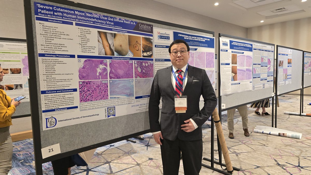 ShuaiLiMDPhD's tweet image. Had a fantastic time @IntSocDermpath #ISDP meeting and catching up with friends! Honored to connect with Drs. Billings, LeBoit, Zembowicz, Brenn, and many more #DermPath legends. Learned valuable insights on the 27-28 fellowship application—excited to refine mine back in Omaha.