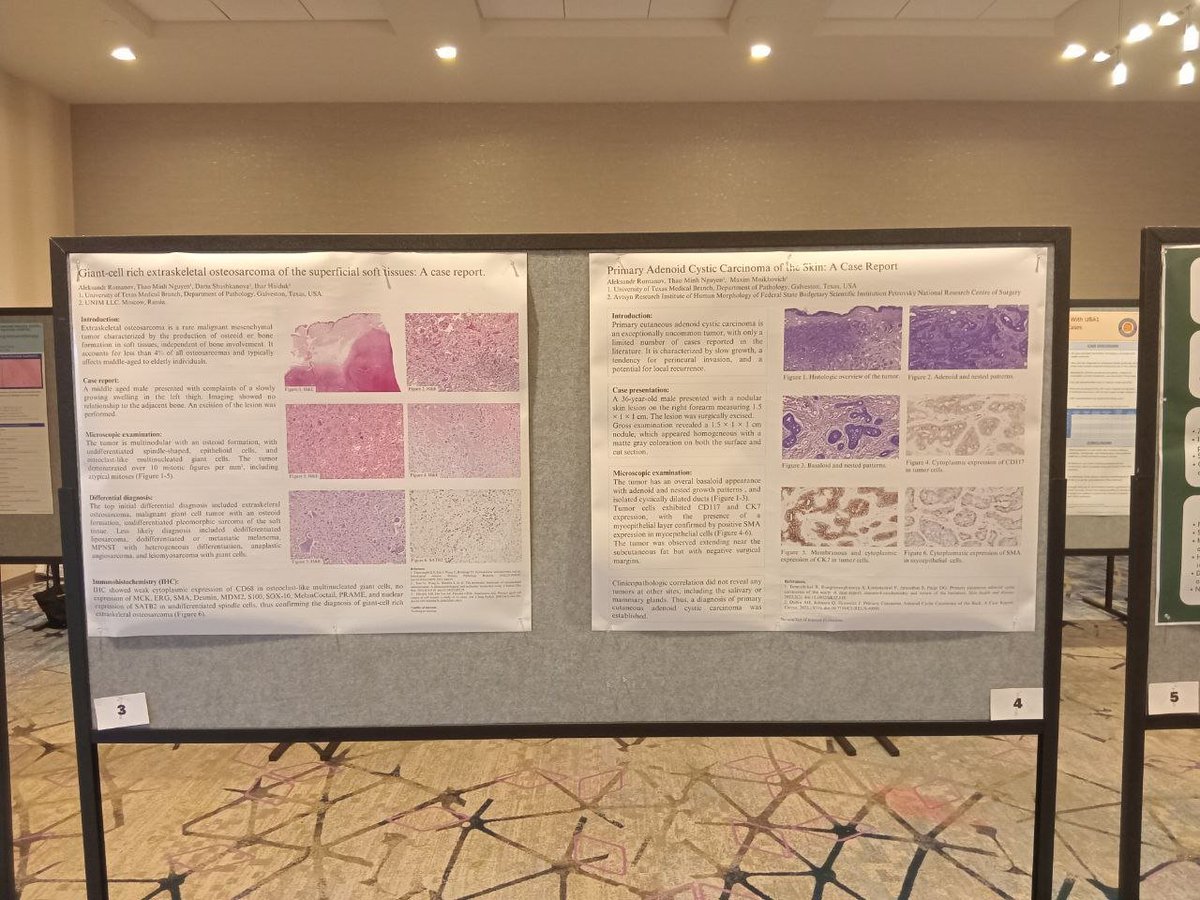 It's been a while since I last participated in an international conference. Honored to present a few of our intriguing cases at the #IDSP   <a href="/IntSocDermpath/">Int Soc Dermpath</a>  conference. Grateful for the opportunity to share and discuss with colleagues in the field! 
#dermpath #PathTwitter