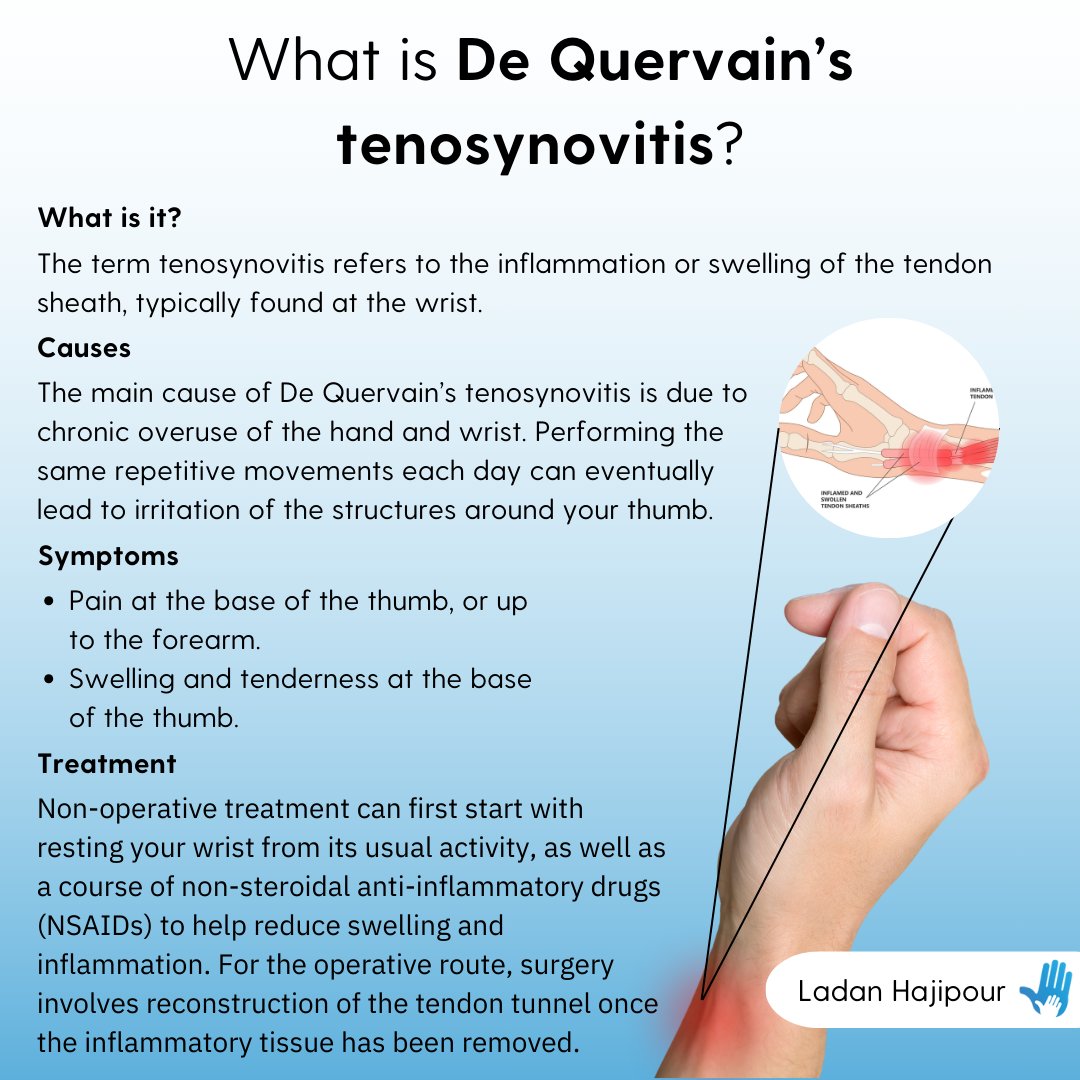 If you are struggling with symptoms relating to de Quervain's, book an appointment or contact us today ladanhajipour.com/book-appointme…

#WristConditions #HandSurgeonManchester #DeQuervainTenosynovitis