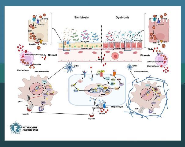 🧬 Recent research explores how gut microbiota influences hepcidin, the master iron regulator, shedding light on liver fibrosis development. 👉  buff.ly/spToNlU

#PathogDis #Microbiome #IronMetabolism #LiverHealth